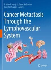 Cover von Cancer Metastasis Through the Lymphovascular System