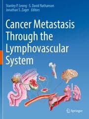 Cover von Cancer Metastasis Through the Lymphovascular System