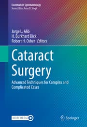 Cover von Cataract Surgery