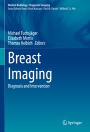 Cover von Breast Imaging