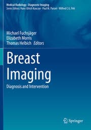Cover von Breast Imaging