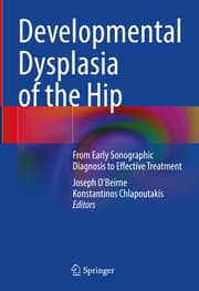 Cover von Developmental Dysplasia of the Hip