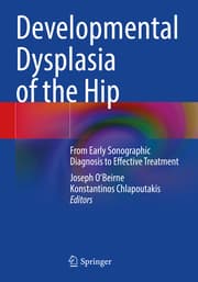 Cover von Developmental Dysplasia of the Hip