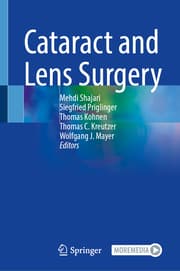 Cover von Cataract and Lens Surgery