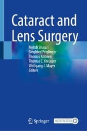 Cover von Cataract and Lens Surgery