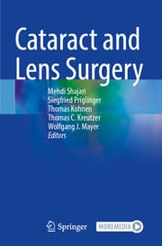 Cover von Cataract and Lens Surgery