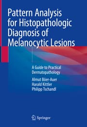 Cover von Pattern Analysis for Histopathologic Diagnosis of Melanocytic Lesions
