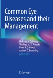 Cover von Common Eye Diseases and their Management