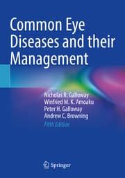 Cover von Common Eye Diseases and their Management
