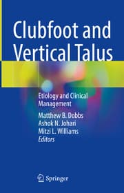Cover von Clubfoot and Vertical Talus