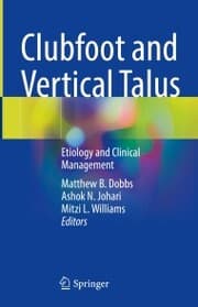 Cover von Clubfoot and Vertical Talus