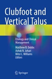 Cover von Clubfoot and Vertical Talus