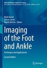 Cover von Imaging of the Foot and Ankle