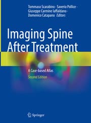Cover von Imaging Spine After Treatment