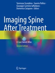 Cover von Imaging Spine After Treatment