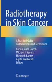 Cover von Radiotherapy in Skin Cancer