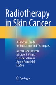 Cover von Radiotherapy in Skin Cancer