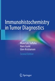 Cover von Immunohistochemistry in Tumor Diagnostics