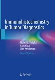 Cover von Immunohistochemistry in Tumor Diagnostics