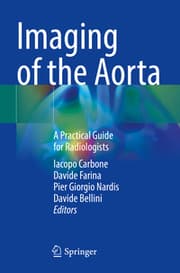 Cover von Imaging of the Aorta