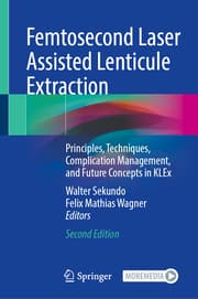 Cover von Femtosecond Laser Assisted Lenticule Extraction