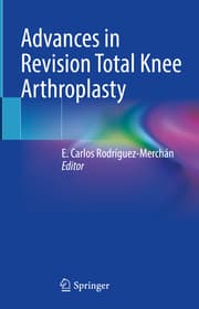 Cover von Advances in Revision Total Knee Arthroplasty