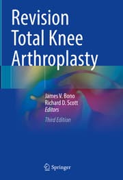 Cover von Revision Total Knee Arthroplasty