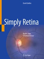 Cover von Simply Retina