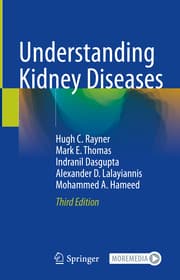 Cover von Understanding Kidney Diseases