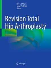 Cover von Revision Total Hip Arthroplasty