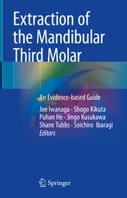 Cover von Extraction of the Mandibular Third Molar