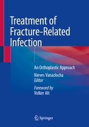 Cover von Treatment of Fracture-Related Infection