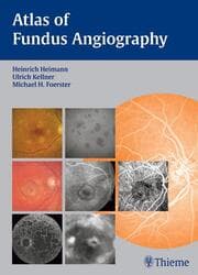 Cover von Atlas of Angiography of the Optic Fundus