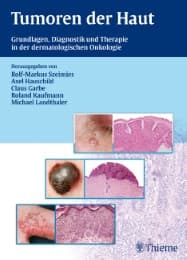 Cover von Tumoren der Haut