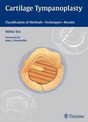 Cover von Cartilage Tympanoplasty