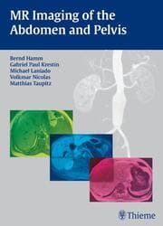 Cover von MR Imaging of the Abdomen and Pelvis