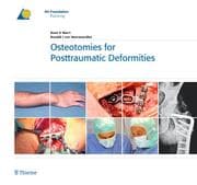 Cover von Osteotomies for Posttraumatic Deformities