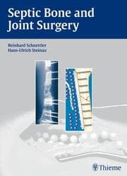 Cover von Septic Bone and Joint Surgery