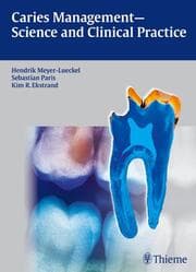 Cover von Dental Caries - Science and Clinical Practice