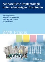 Cover von Zahnärztliche Implantologie unter schwierigen Umständen