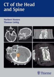 Cover von CT of the Head and Spine