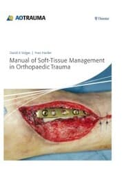 Cover von Manual of Soft-Tissue Management in Orthopaedic Trauma