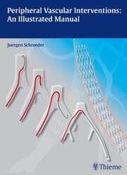 Cover von Peripheral Vascular Interventions: An Illustrated Manual