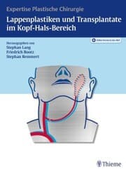 Cover von Lappenplastiken und Transplantate im Kopf-Hals-Bereich