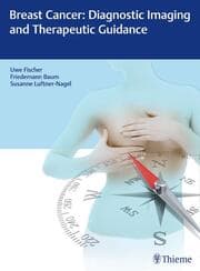 Cover von Breast Cancer: Diagnostic Imaging and Therapeutic Guidance