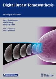 Cover von Digital Breast Tomosynthesis