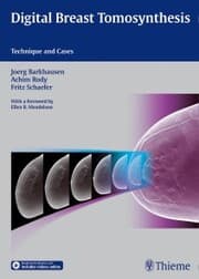 Cover von Digital Breast Tomosynthesis