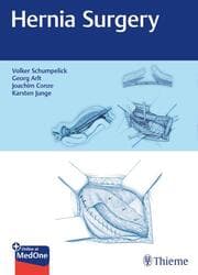 Cover von Hernia Surgery
