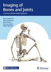 Cover von Imaging of Bones and Joints