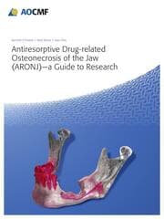 Cover von Antiresorptive Drug-Related Osteonecrosis of the Jaw (ARONJ) - A Guide to Research